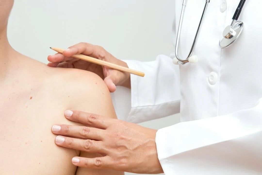 Adenocarcinoma: Causas, Síntomas y Tratamiento