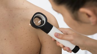 cancer-piel-prevencion-onco-portada-lp.jpg