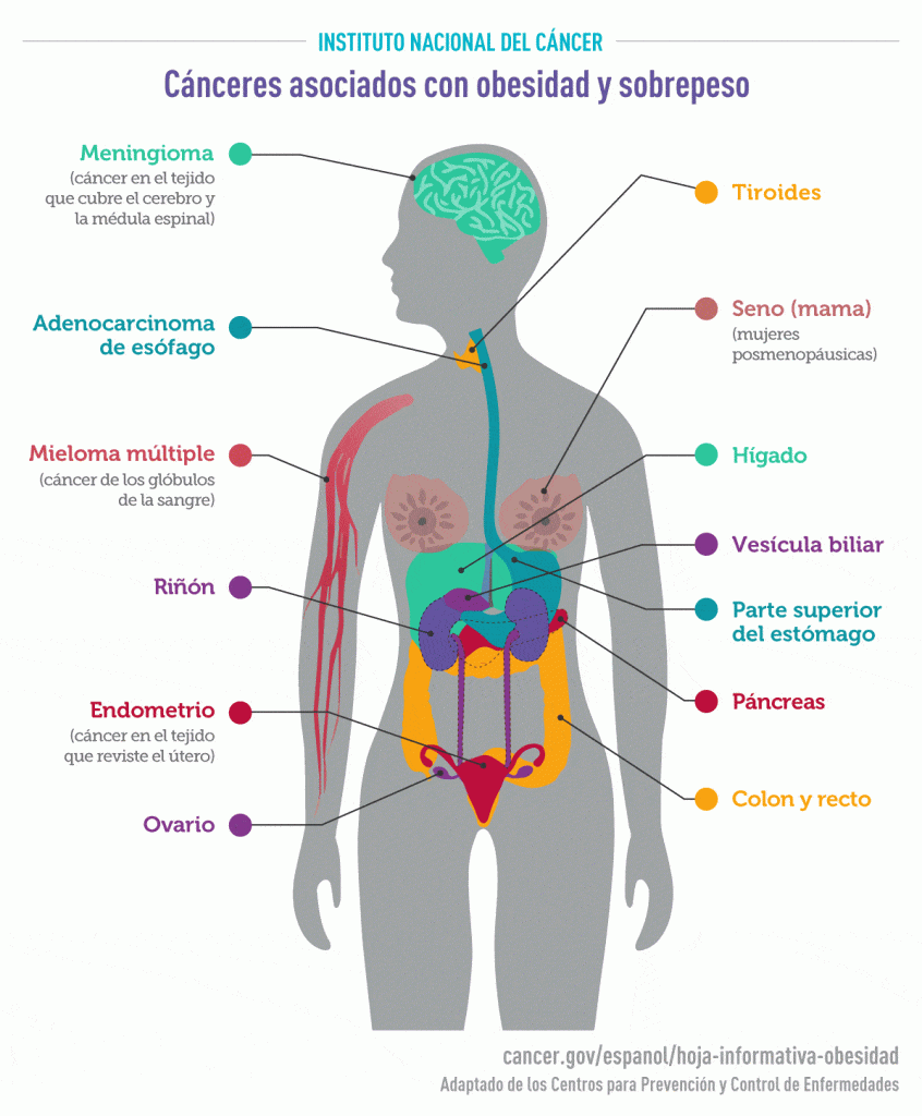 la obesidad y su influencia en el cáncer