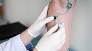 Angiogénesis: Qué Debes Saber al Respecto