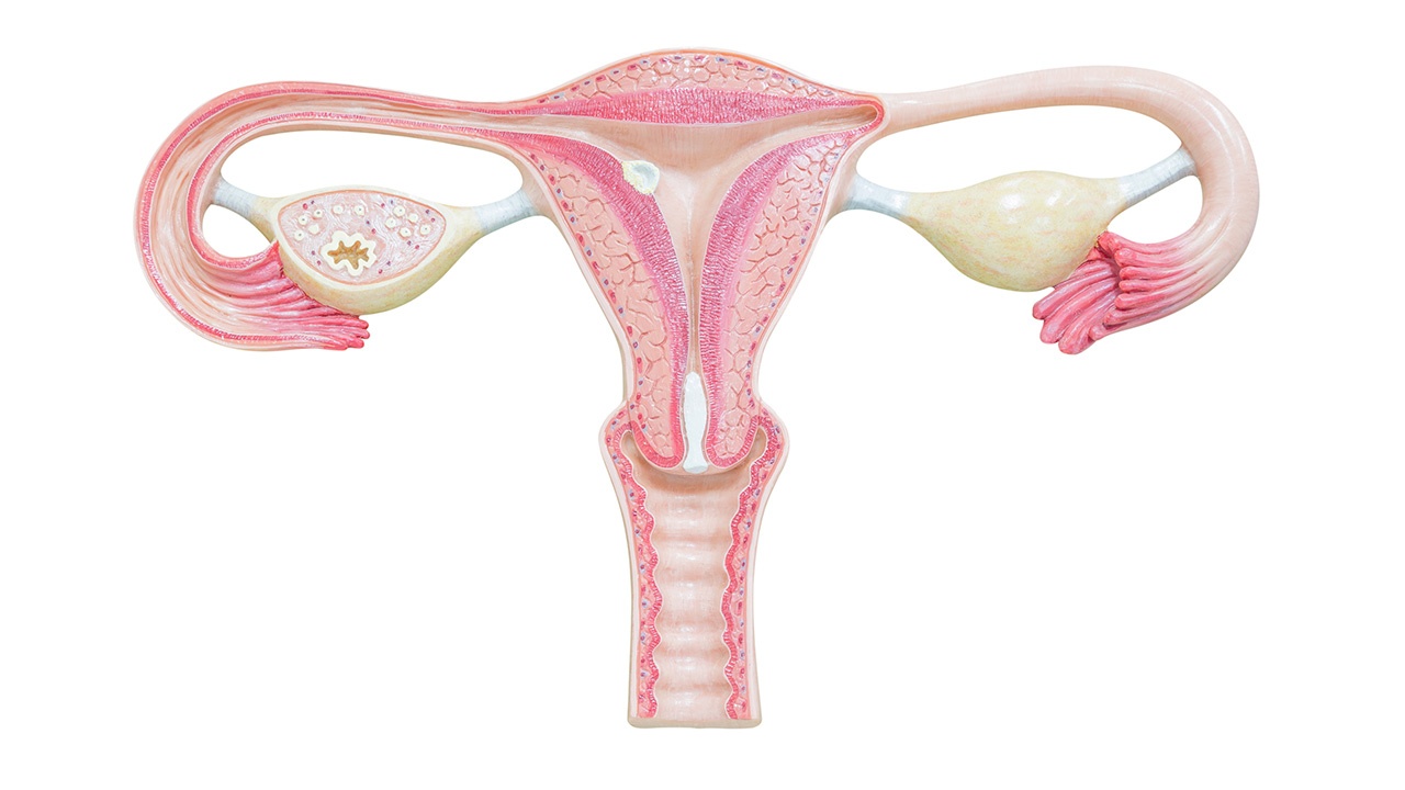 cancer-de-utero-sintomas