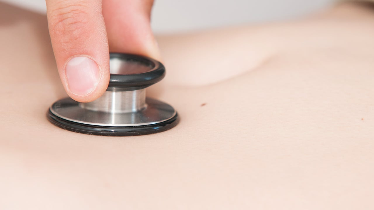 Diverticulitis
