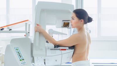 ¿Cada cuánto se debe hacer la mamografía?