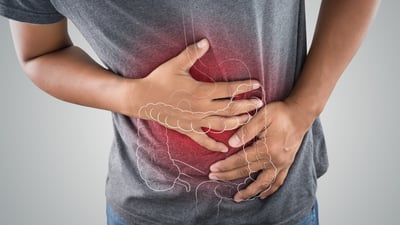 Atento a estos síntomas: podrían indicar cáncer de colon