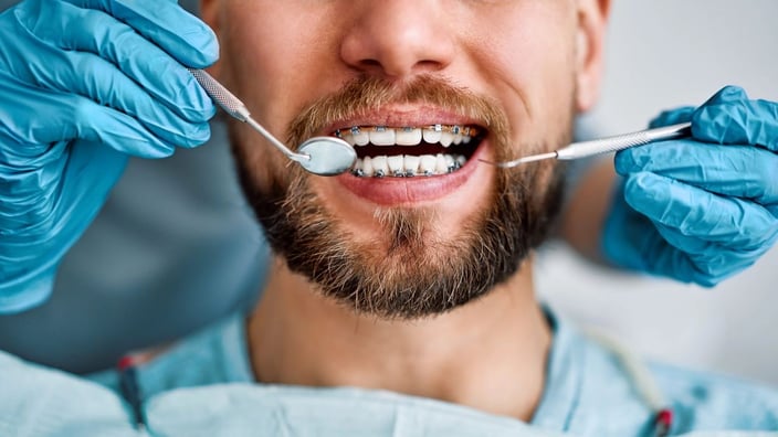 cancer de boca como prevenir el cancer oral