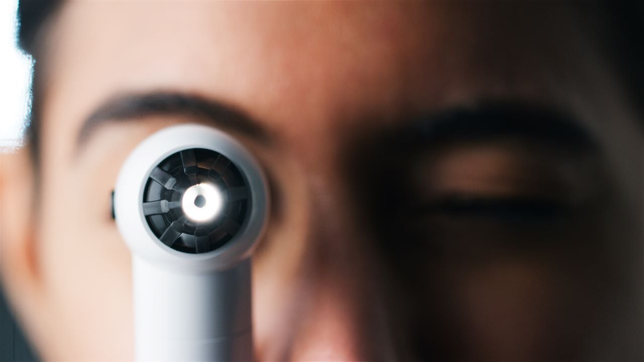 cancer ocular cuidados durante tratamiento