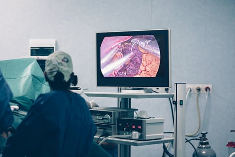 Tratamientos para cáncer colorrectal: opciones efectivas y accesibles
