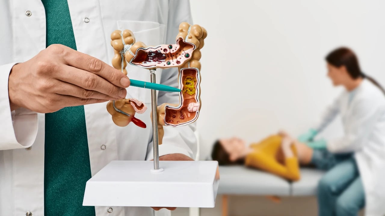 Cómo Prevenir El Cáncer De Colon Consejos Que Ayudan A Su Prevención Cómo Prevenir El Cáncer De Colon Consejos Que Ayudan A Su Prevención