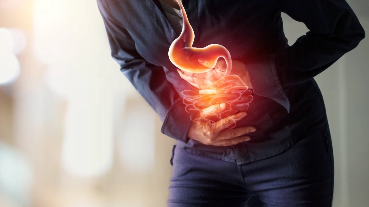 cuales son los sintomas del cancer de colon