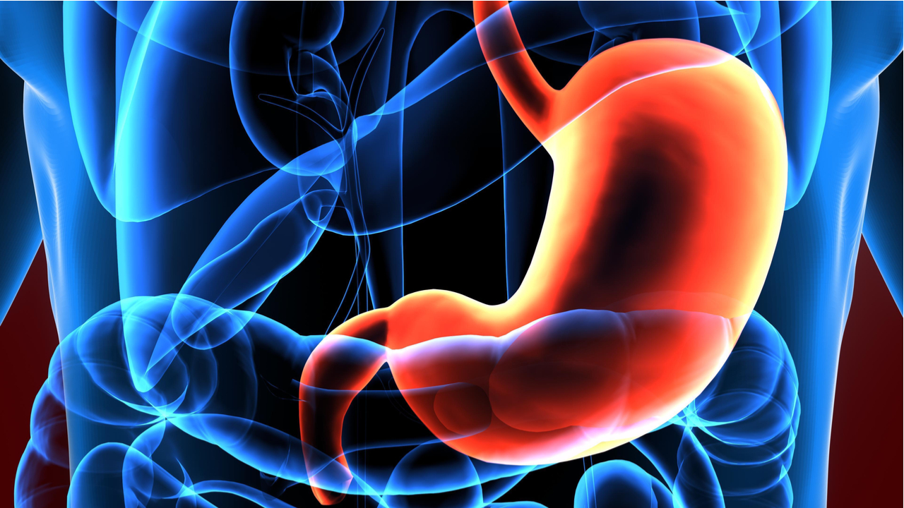 el-cancer-de-estomago-es-hereditario