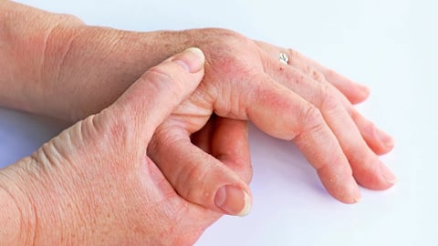 4 enfermedades en la piel más comunes en adultos mayores