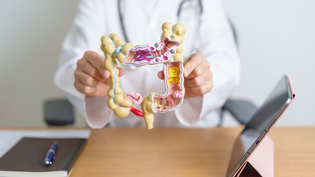 examenes para detectar de cancer colorrectal