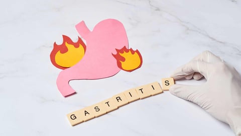 ¿La Gastritis Crónica Tiene Cura?
