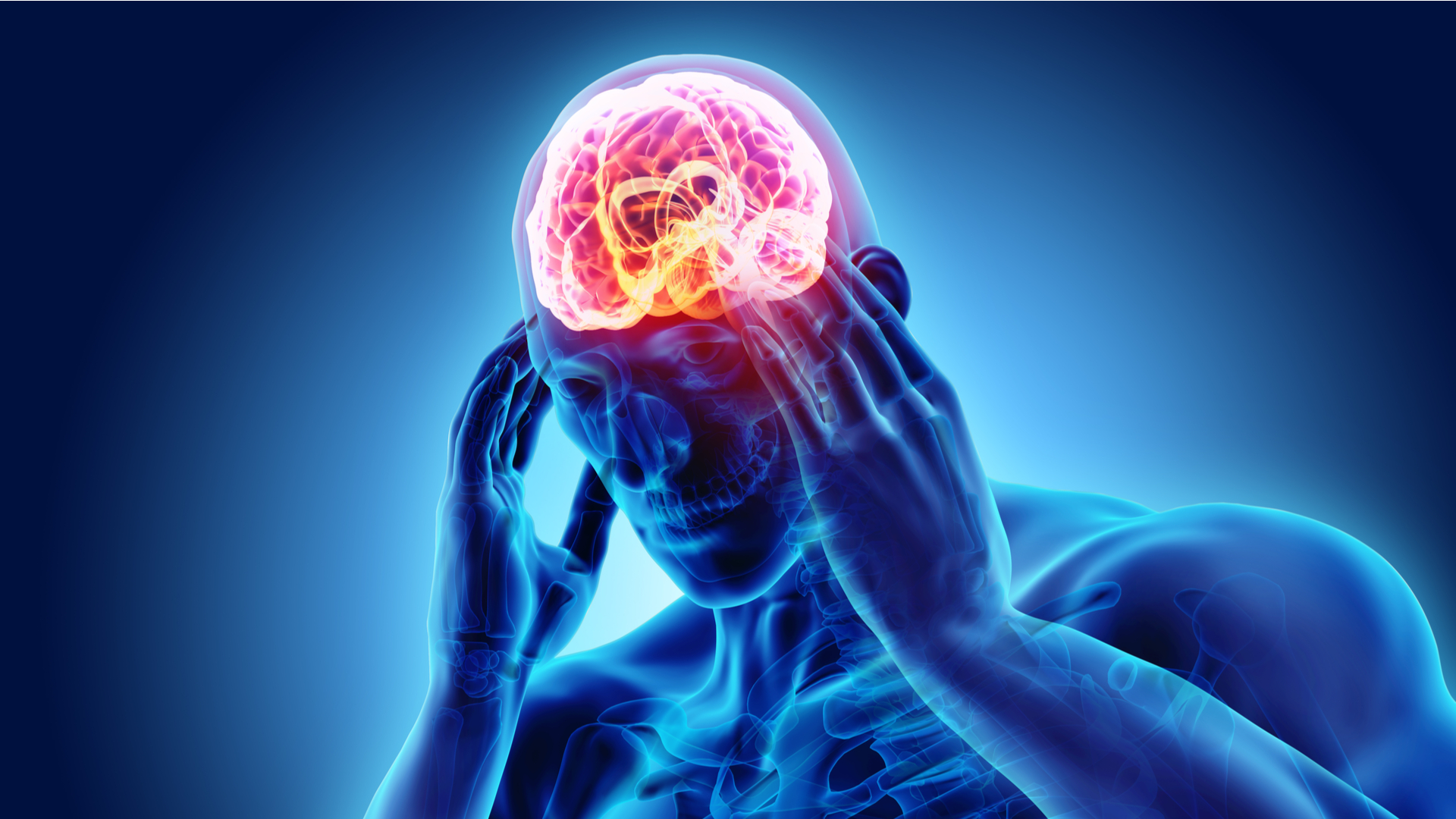 infarto cerebral