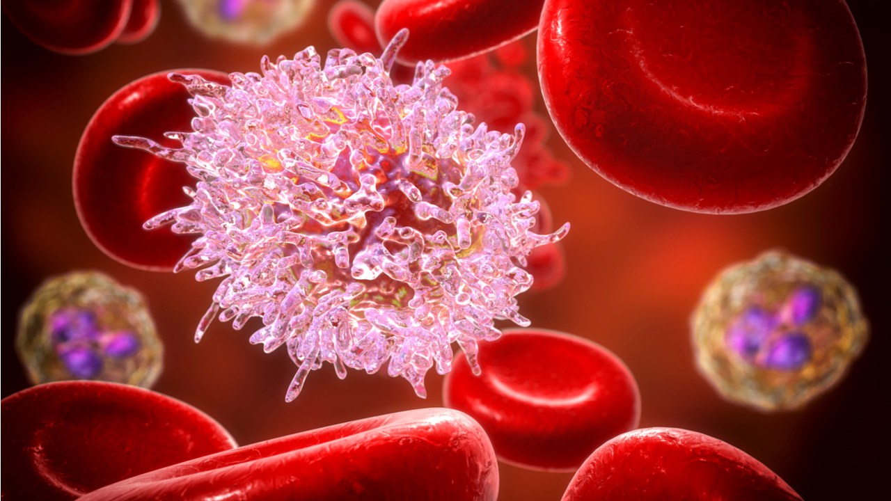 De Qué Proviene la Leucemia