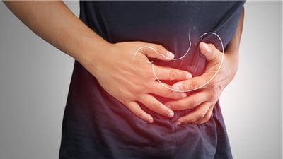 Cómo prevenir el Cáncer de Estómago: Mitos y verdades