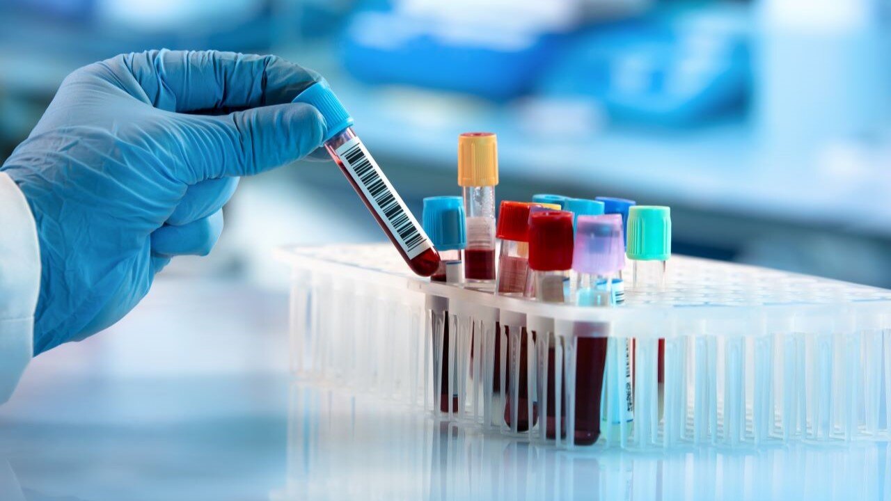 panel genetico para mutaciones en genes que aumentan riesgo de cancer