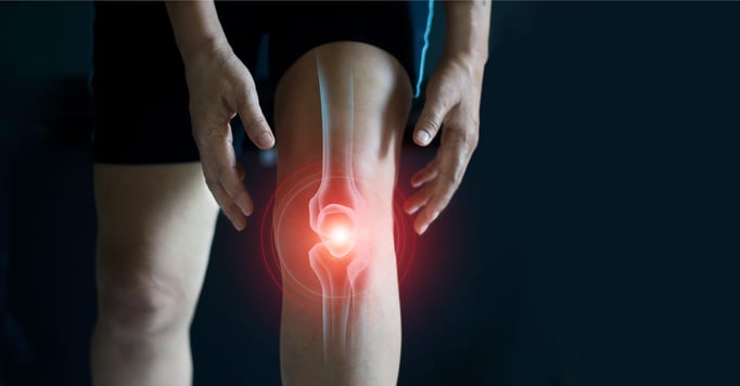 ¿Por qué suenan las rodillas? 4 señales que indican una lesión