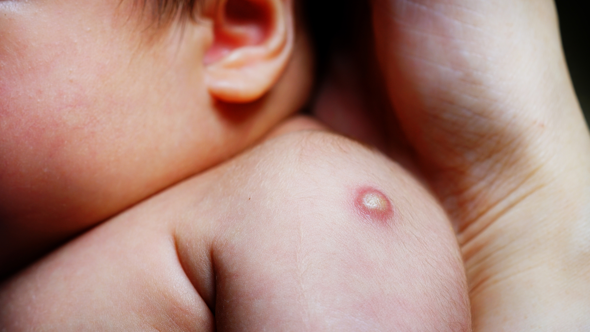 primera vacuna del bebe