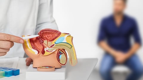 Próstata inflamada: síntomas, causas y tratamiento efectivo