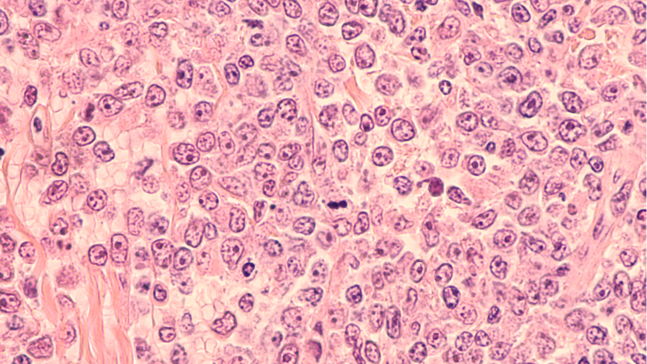 Linfocitos vistos desde microscopio