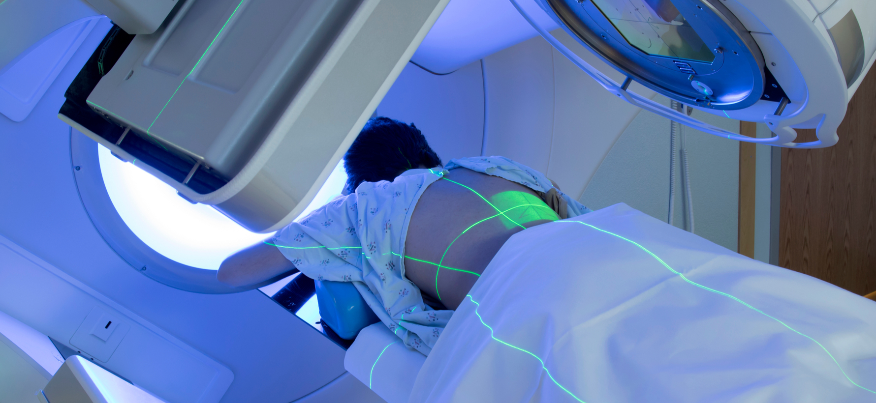 paciente haciendo radioterapia