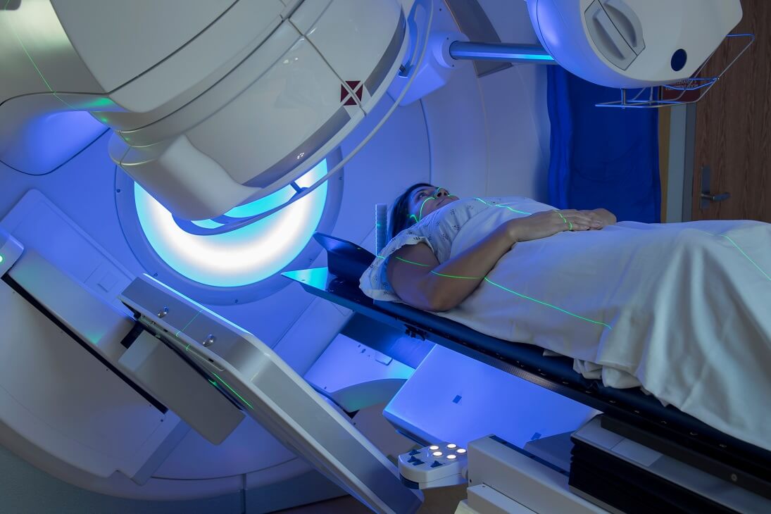 La radioterapia es uno de los tratamientos contra el cáncer de pulmón.