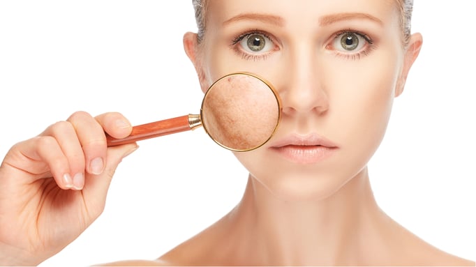 ¿Se puede eliminar lunares de forma natural? ¿Cuánto tarda?
