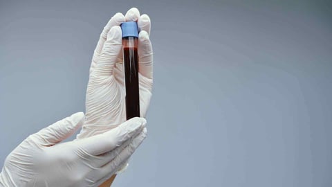 Síntomas de Cáncer a la Sangre: Qué Debes Saber