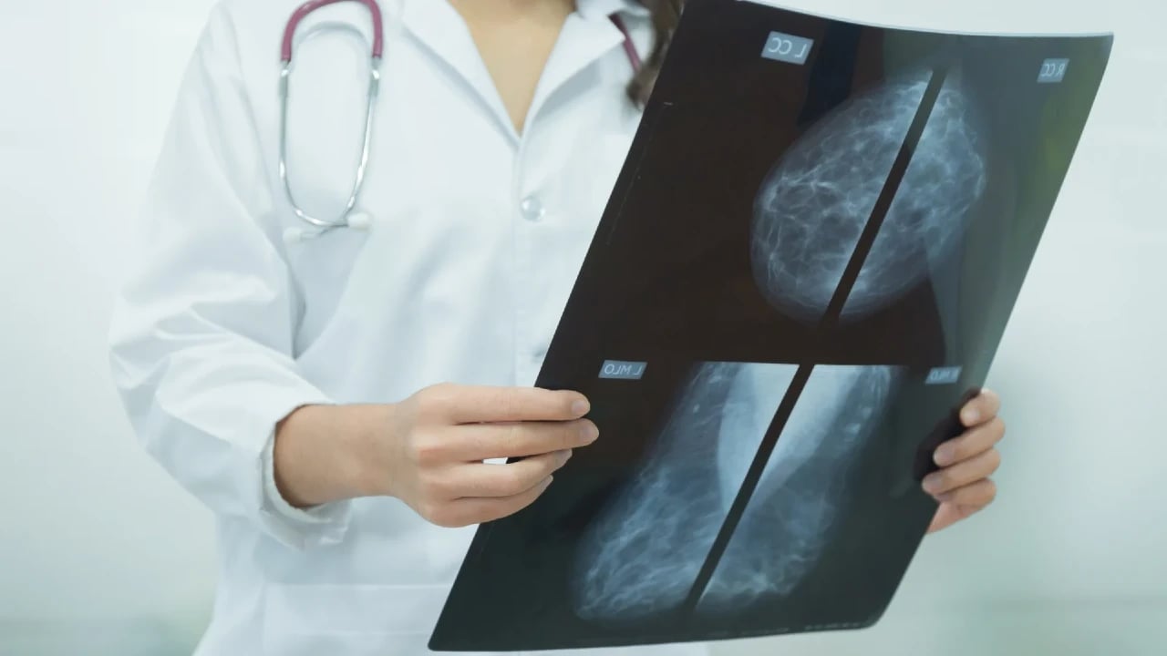 tipos de mamografia digital 3d