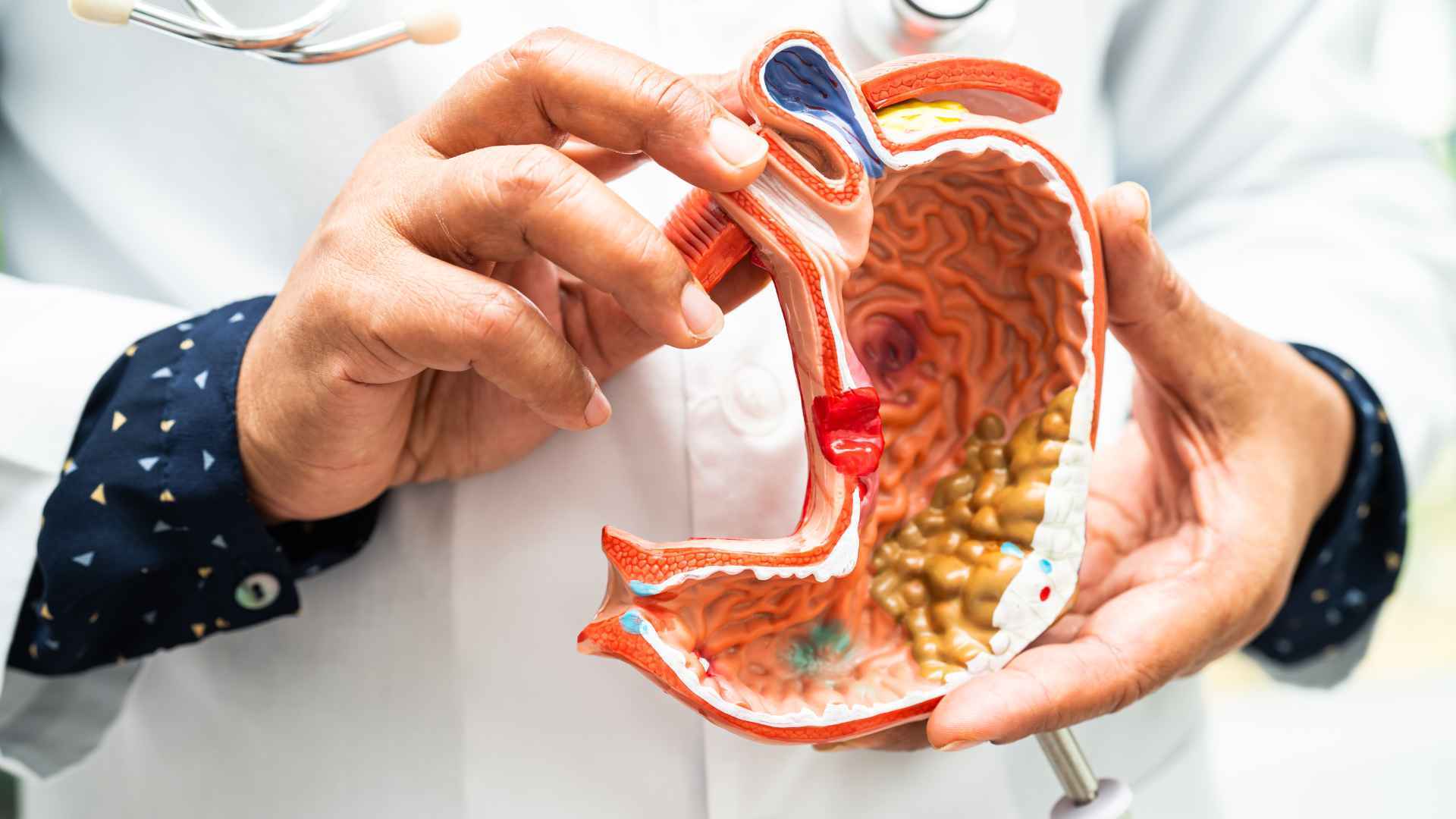 Probióticos: Cuáles Son los Beneficios