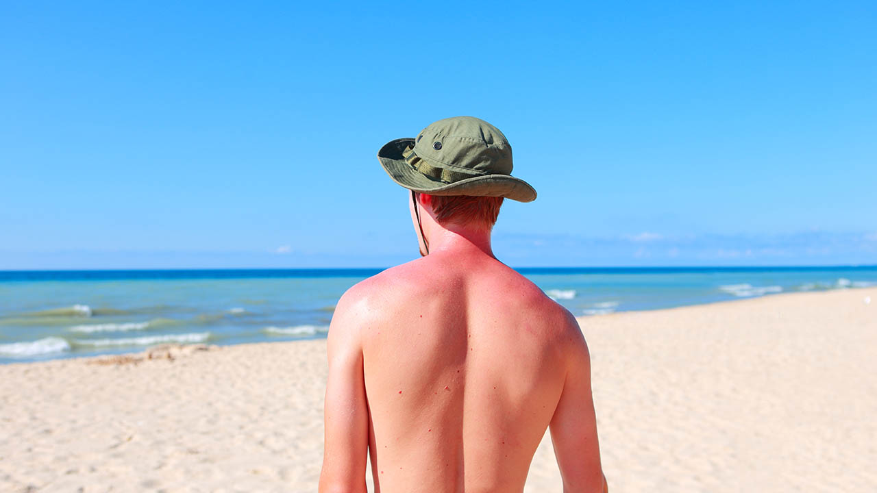 como los rayos UV afecta tu piel portada