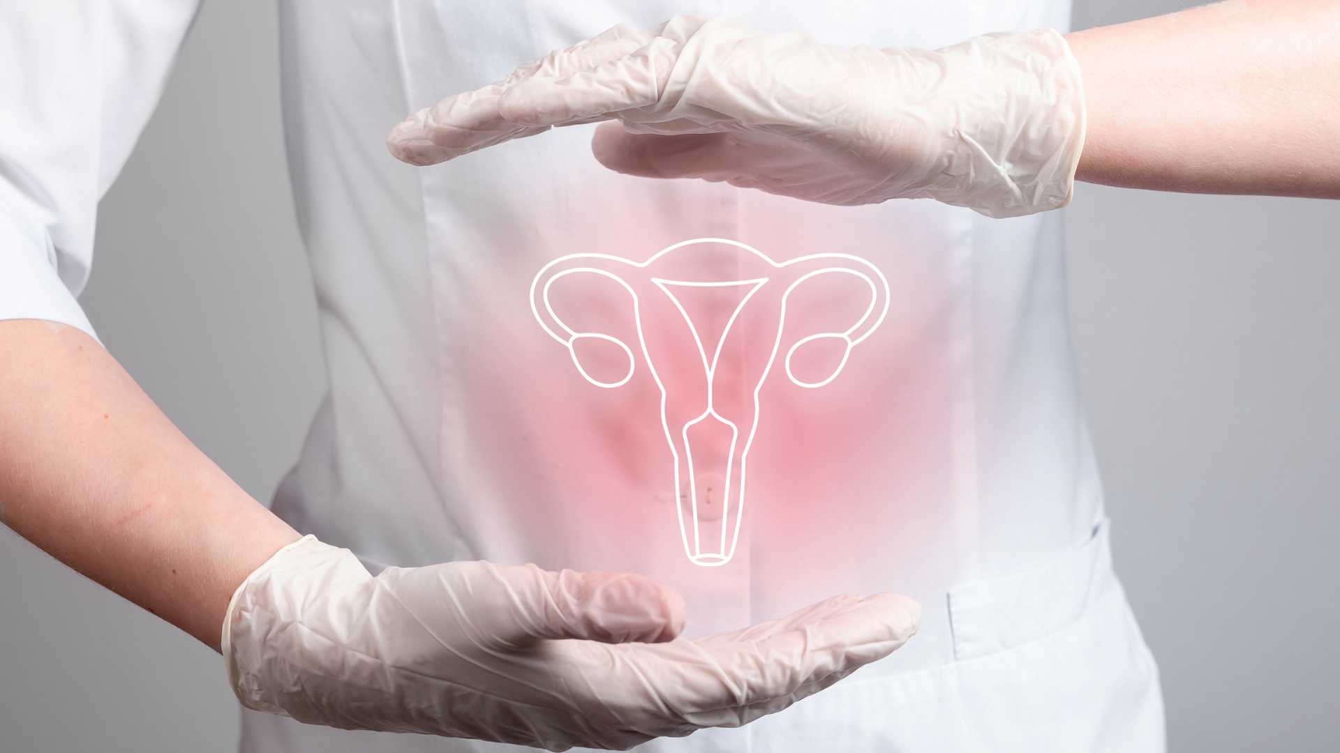Endometrio Engrosado: Causas, Síntomas y Tratamiento