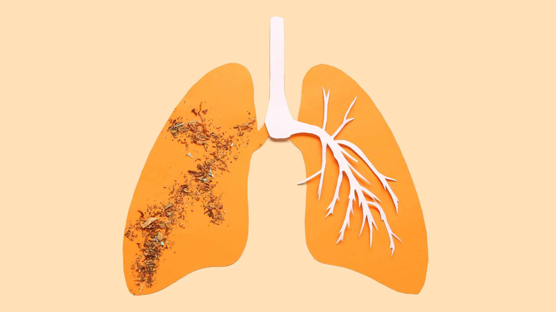 Enfisema Pulmonar: Causas, Síntomas y Tratamiento