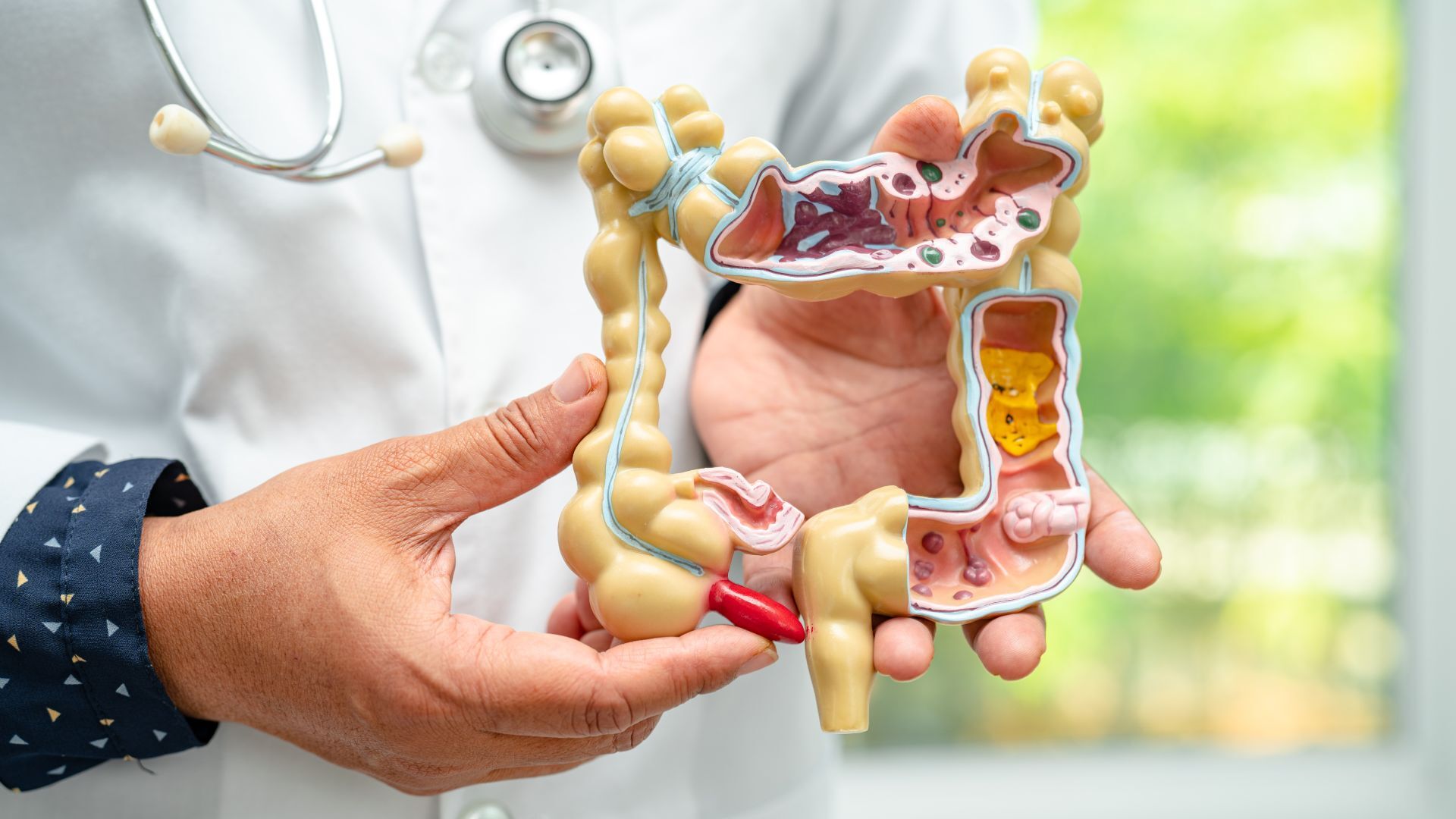 examenes para detectar el cancer de colon