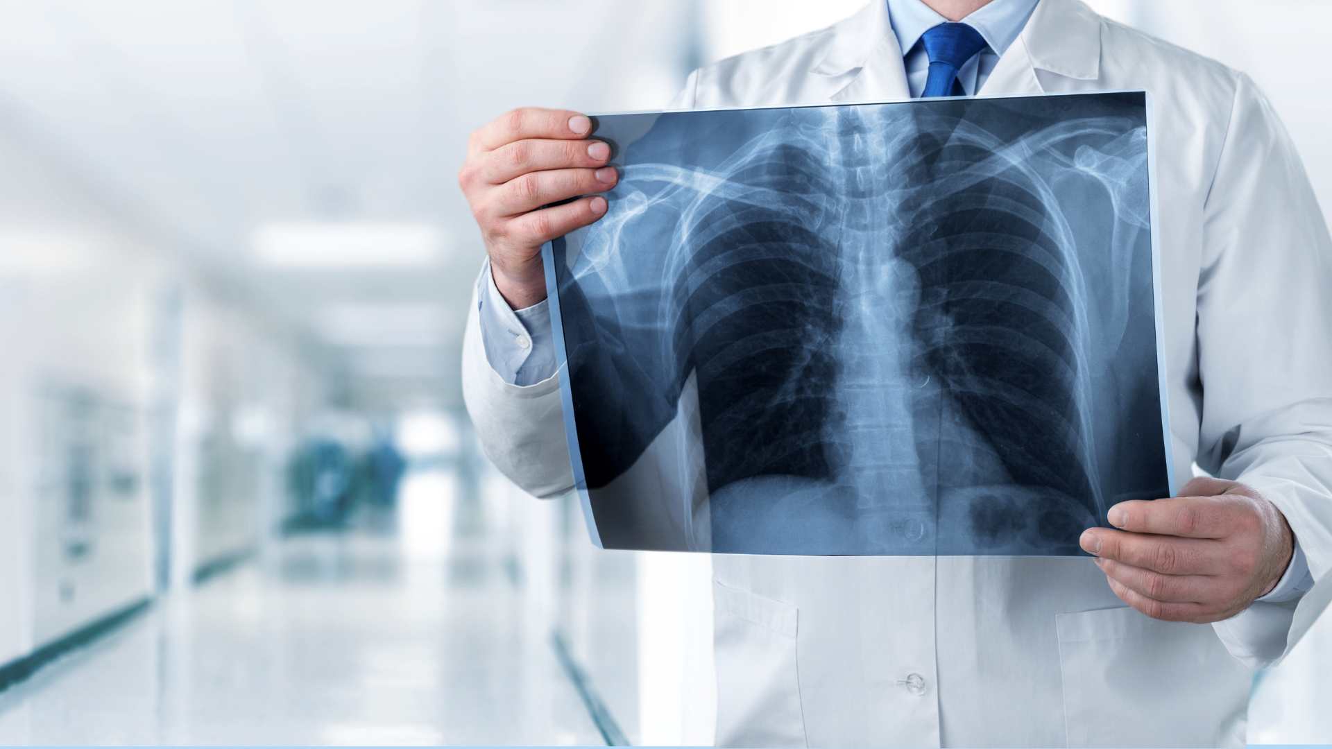 Radiografía de Columna: Cuándo se realiza y Qué Diagnostica