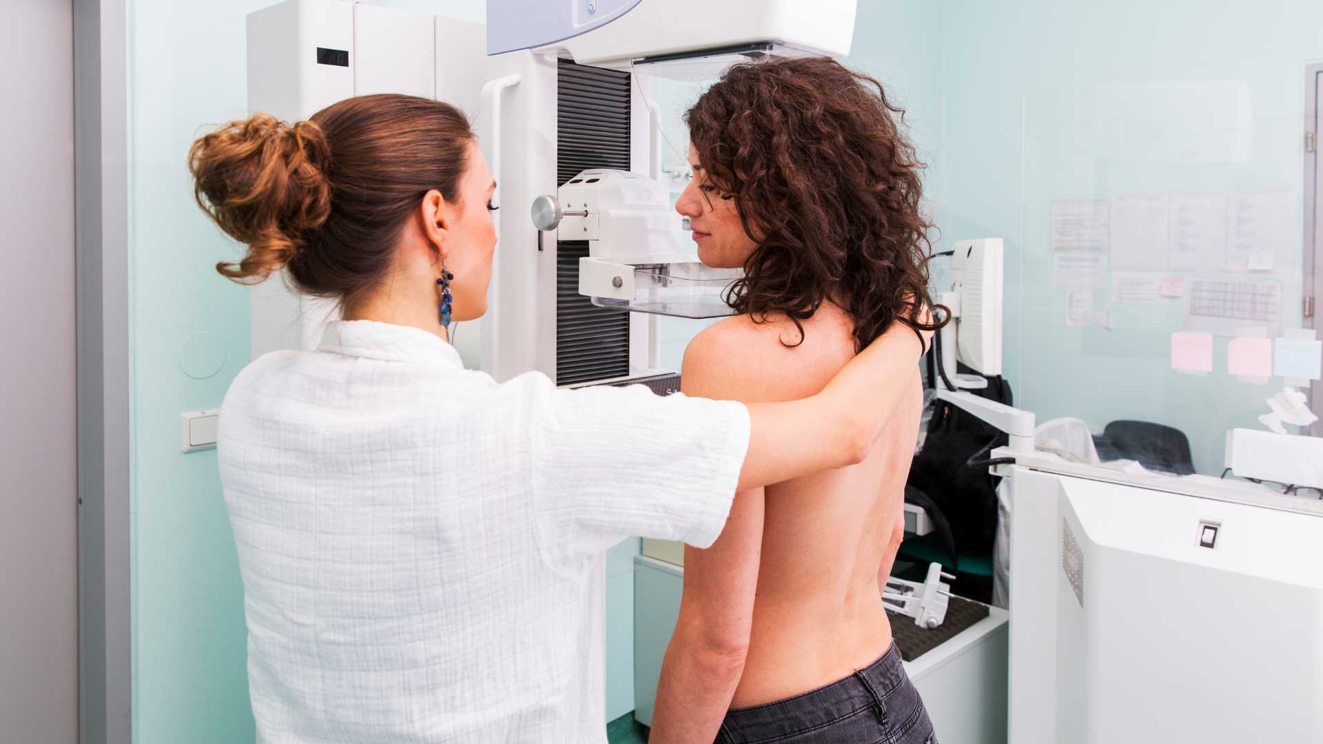 Requisitos para Hacerse una Mamografía: Cuáles Son