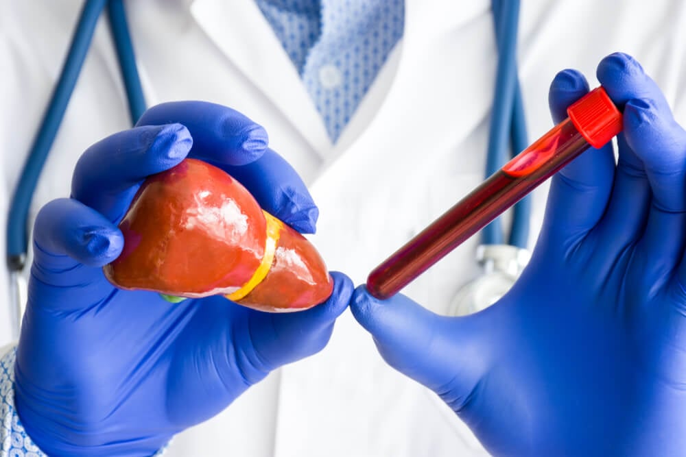 Perfil hepático: ¿Por qué es importante para el cuidado de tu hígado?
