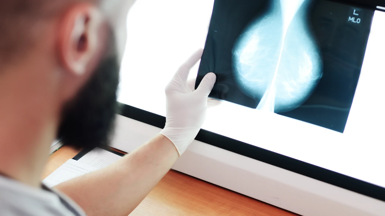 tipos-de-cancer-de-mama-diagnostico-mamografia